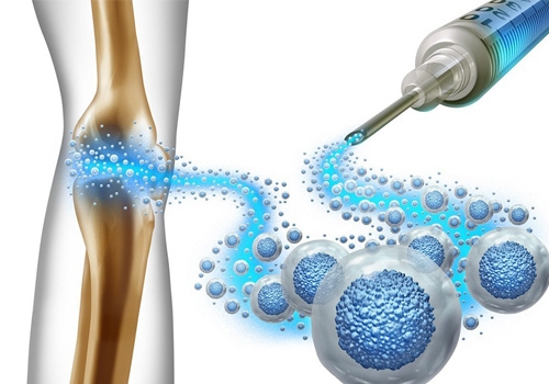 Cellular Therapy Charleston: Everything You Need to Know about Bone Marrow and Fat