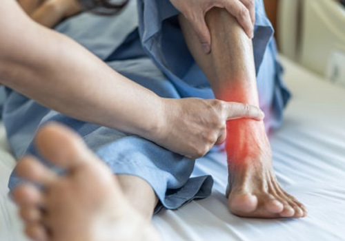 What is Ankle Arthritis & How Do You Treat It?